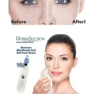 Derma Suction Vacuum Blackhead and Facial Cleaning Device,